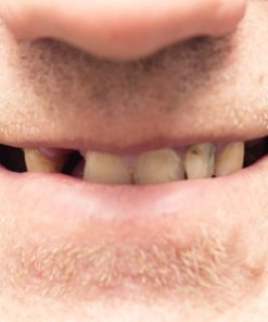Oral Impact of Tobacco Home Study Book- 2 CEUs: Downloadable