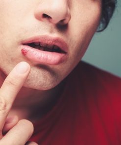 Herpes Home Study Book .. 5 CEU's- Downloadable